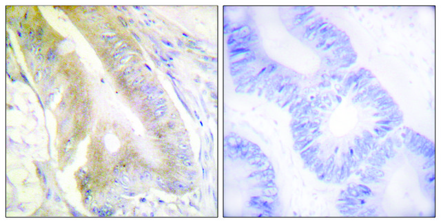 Anti-IREB1 antibody produced in rabbit