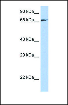 Anti-ZNF676 antibody produced in rabbit