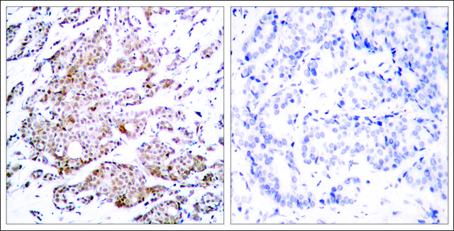 Anti-phospho-MYC (pThr??) antibody produced in