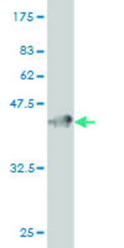 Monoclonal Anti-GUCY2C antibody produced in