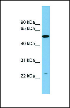 Anti-PAOX, (N-terminal) antibody produced in