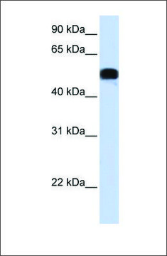 Anti-FOXA1 (ab2) antibody produced in
