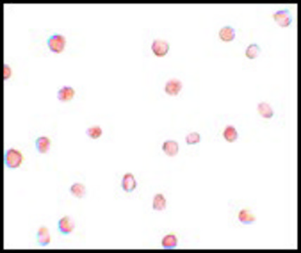 Anti-FAM82A1 antibody produced in chicken