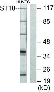 Anti-ZNF387 antibody produced in rabbit