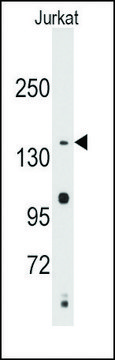 Anti-SULT1C2 (N-term) antibody produced in