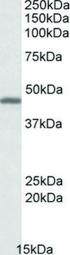 Anti-GPR17 (C-terminal) antibody produced in