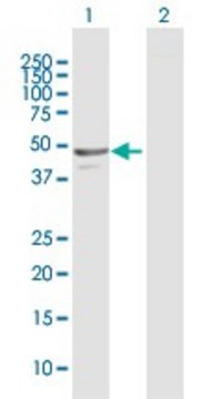 Anti-NAPRT1 antibody produced in rabbit