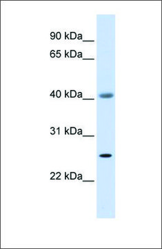 Anti-ADA antibody produced in rabbit