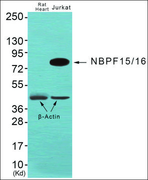 Anti-NBPF1/9/10/12/14/15/16/20 antibody produced in rabbit