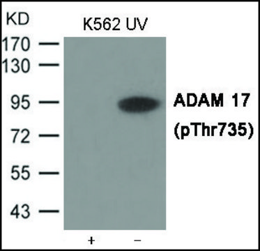 Anti-phospho-ADAM 17 (pThr?³?) antibody produced