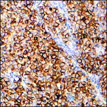 Anti-PLAP antibody, Rabbit monoclonal