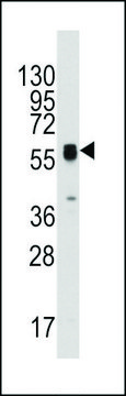 ANTI-ECGF1 (CENTER) antibody produced in