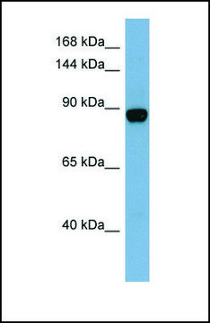 Anti-CASD1, (N-terminal) antibody produced in