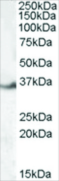 Anti-LASP1 (Internal REGION) antibody produced
