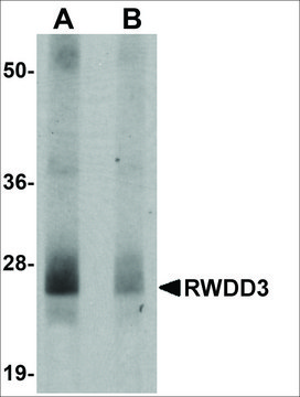 Anti-RWDD3 antibody produced in rabbit