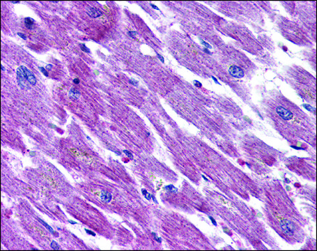 Anti-ADCYAP1R1 antibody produced in rabbit
