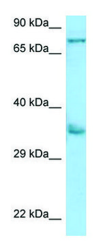 Anti-KIR2DS2 (N-terminal) antibody produced in