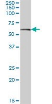 Anti-AMY1B antibody produced in mouse