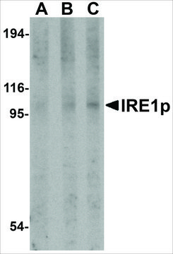 Anti-IRE1P (ab3) antibody produced in