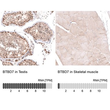 Anti-BTBD7 antibody produced in rabbit