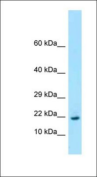 Anti-RPL26 antibody produced in rabbit