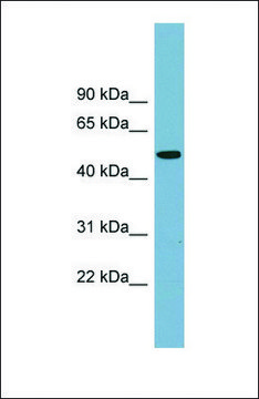 Anti-PRSS16 antibody produced in rabbit