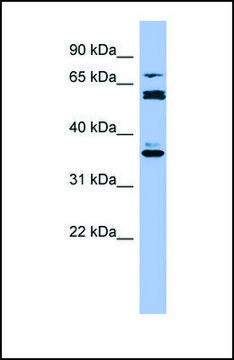 Anti-CYP2B6 antibody produced in rabbit