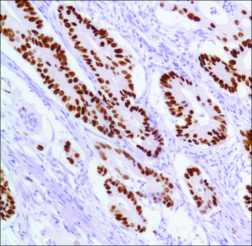 Anti-P53 antibody, Rabbit monoclonal