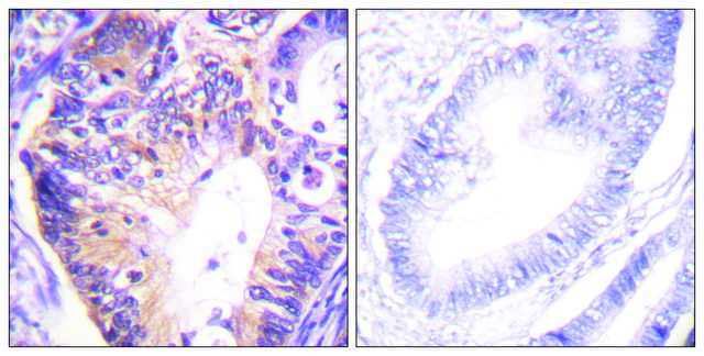 Anti-PAK1 antibody produced in rabbit