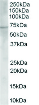 Anti-Choline acetyltransferase antibody produced in