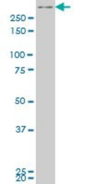 ANTI-SMG1 antibody produced in mouse