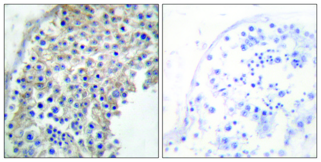 Anti-Adrenergic Receptor ?-2A antibody produced