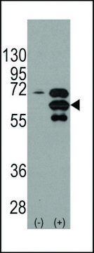 ANTI-INA (ALPHA INTERNEXIN) (CENTER) antibody