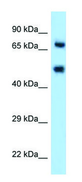 Anti-SELE (N-terminal) antibody produced in