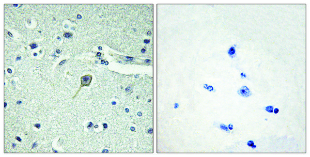 Anti-PTHR1 antibody produced in rabbit