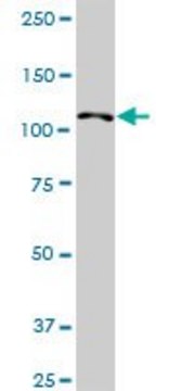 Anti-HIP1R antibody produced in rabbit