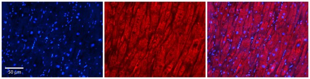 Anti-LPL (C-terminal) antibody produced in