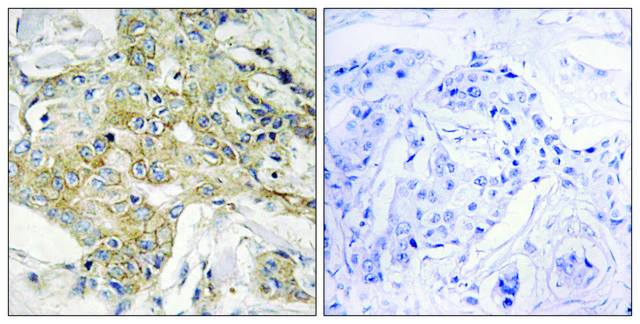 Anti-T4S1 antibody produced in rabbit