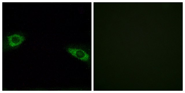Anti-RPS4Y1 antibody produced in rabbit