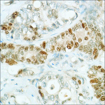 Anti-MSH6 antibody, Rabbit monoclonal