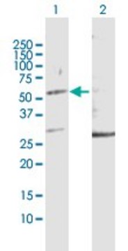 Anti-KRT32 antibody produced in rabbit