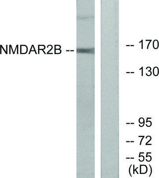 Anti-NMDAR2B antibody produced in rabbit
