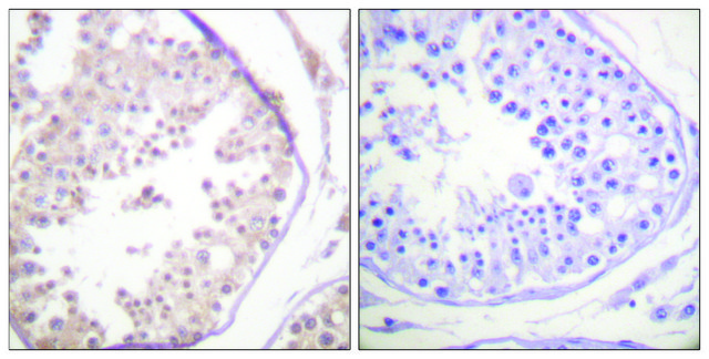 Anti-RAD52 antibody produced in rabbit
