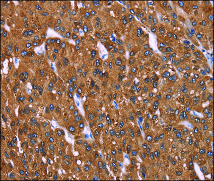 Anti-HRASLS2 antibody produced in rabbit