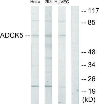 Anti-ADCK5 antibody produced in rabbit