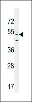 ANTI-AGFG2 (CENTER) antibody produced in