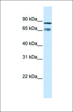 Anti-IKZF1 antibody produced in rabbit