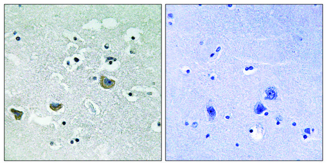 Anti-SREBP-1 antibody produced in rabbit