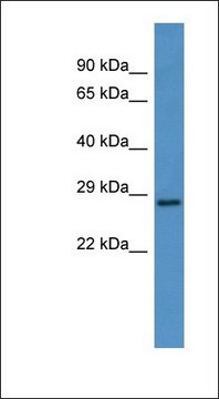 Anti-CEACAM7 antibody produced in rabbit