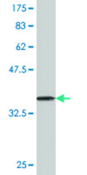 Monoclonal Anti-DDEF1, (C-terminal) antibody produced